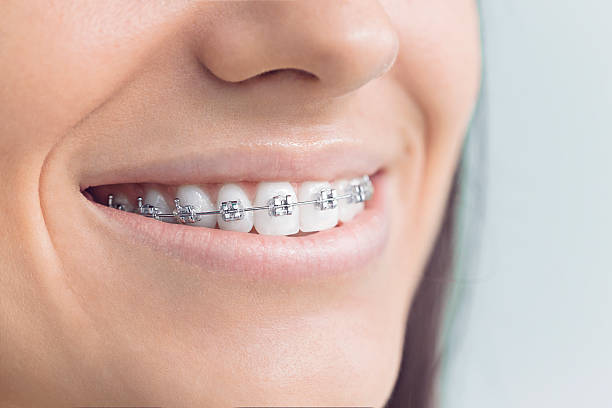 Best Traditional Braces  in Lebanon, IL